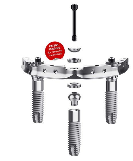 Trefoil implant system for full arch restorations