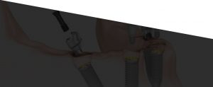 Illustration of how All-on-4 prosthetic fits in lower jawbone