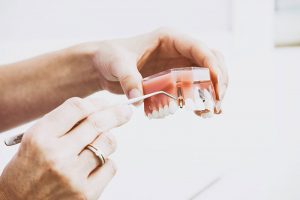 A woman's hands holding an acrylic model of an arch of teeth using a dental implement to highlight a dental implant fixture